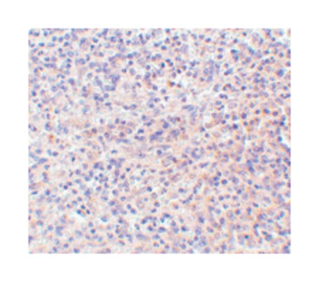 ANTI-CD180 ANTIBODY 100UG