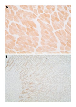 Dcun1d4, Rabbit, Polyclonal Antibody, Abnova 25 &mu;g | Buy Online | Abnova Corporation | Fisher Scientific