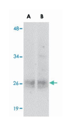 EPHA10, Rabbit, Polyclonal Antibody, Abnova 100 &mu;g | Buy Online | Abnova Corporation | Fisher Scientific
