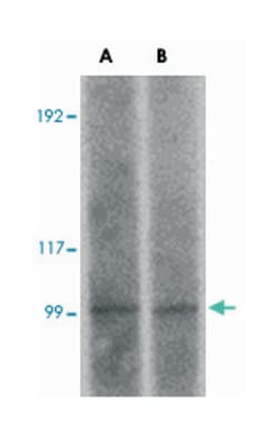 FRMPD2, Rabbit, Polyclonal Antibody, Abnova 100 &mu;g | Buy Online | Abnova | Fisher Scientific