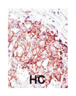 MIB1, Rabbit, Polyclonal Antibody, Abnova 400&mu;L; Unlabeled:Antibodies,