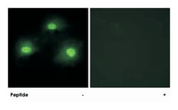 PKIA, Rabbit, Polyclonal Antibody, Abnova 100&mu;g; Unlabeled:Antibodies,