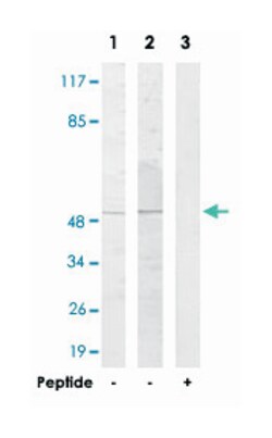 CELF1, Rabbit, Polyclonal Antibody, Abnova 100 &mu;g | Buy Online | Abnova Corporation | Fisher Scientific