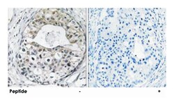 RPS13 Rabbit anti-Human, Mouse, Rat, Polyclonal Antibody, Abnova 100&mu;g;