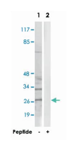 CBLN4, Rabbit, Polyclonal Antibody, Abnova 100&mu;g; Unlabeled:Antibodies,