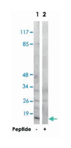 MRPS21, Rabbit, Polyclonal Antibody, Abnova 100 &mu;g | Buy Online | Abnova Corporation | Fisher Scientific