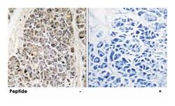 MRPS21, Rabbit, Polyclonal Antibody, Abnova 100 &mu;g | Buy Online | Abnova Corporation | Fisher Scientific