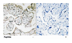ME2 Rabbit anti-Human, Mouse, Polyclonal Antibody, Abnova 100&mu;g; Unlabeled:Antibodies,