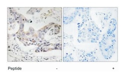 ALDH3B1, Rabbit, Polyclonal Antibody, Abnova 100&mu;g; Unlabeled:Antibodies,