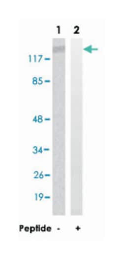 CSF2RB Rabbit anti-Human, Mouse, Rat, Polyclonal Antibody, Abnova 100&mu;g;
