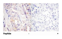 MAP2K1 Rabbit anti-Human, Mouse, Rat, Polyclonal Antibody, Abnova 100&mu;g;