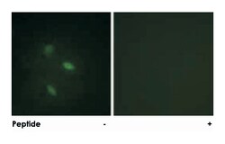 CCNE2 Rabbit anti-Human, Mouse, Polyclonal Antibody, Abnova 100 &mu;g | Buy Online | Abnova Corporation | Fisher Scientific