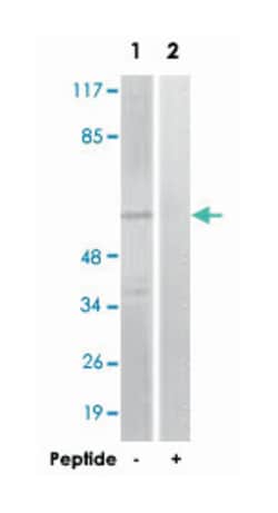 GRK1 Rabbit anti-Human, Mouse, Rat, Polyclonal Antibody, Abnova 100&mu;g;