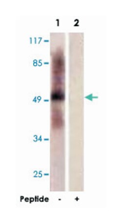 TPH1 Rabbit anti-Human, Mouse, Rat, Polyclonal Antibody, Abnova 100 &mu;g | Buy Online | Abnova Corporation | Fisher Scientific