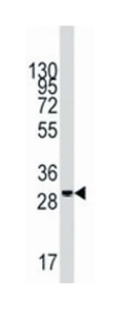 KITLG Rabbit anti-Human, Polyclonal Antibody, Abnova 400&mu;L; Unlabeled:Antibodies,