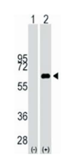 MYC Rabbit anti-Human, Polyclonal Antibody, Abnova 400&mu;L; Unlabeled:Antibodies,