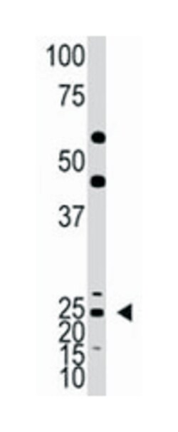 ASCL1, Rabbit, Polyclonal Antibody, Abnova 400&mu;L; Unlabeled:Antibodies,