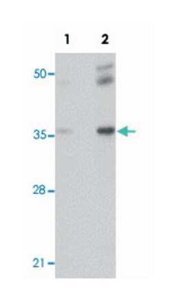 RHBDD2 Rabbit anti-Human, Mouse, Rat, Polyclonal Antibody, Abnova 100&mu;g;