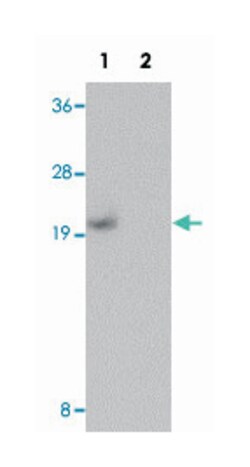 PIAS1 Rabbit anti-Human, Mouse, Rat, Polyclonal Antibody, Abnova 100 &mu;g | Buy Online | Abnova Corporation | Fisher Scientific