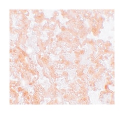 MFSD2, Rabbit, Polyclonal Antibody, Abnova 100&mu;g; Unlabeled:Antibodies,