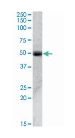 ACPP Goat anti-Human, Polyclonal Antibody, Abnova 100&mu;g; Unlabeled:Antibodies,
