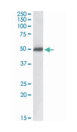 ACPP Goat anti-Human, Polyclonal Antibody, Abnova 100&mu;g; Unlabeled:Antibodies,