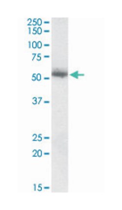 CPNE1, Goat, Polyclonal Antibody, Abnova 100&mu;g; Unlabeled:Antibodies,