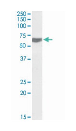 TERF2IP, Goat, Polyclonal Antibody, Abnova 100&mu;g; Unlabeled:Antibodies,