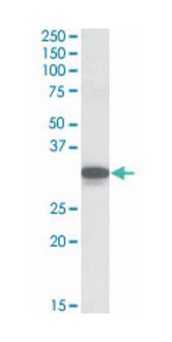 Cyb5r3 Goat anti-Mouse, Rat, Polyclonal Antibody, Abnova 100 &mu;g | Buy Online | Abnova Corporation | Fisher Scientific