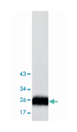 STXBP6, Rabbit, Polyclonal Antibody, Abnova 100 &mu;g | Buy Online | Abnova Corporation | Fisher Scientific