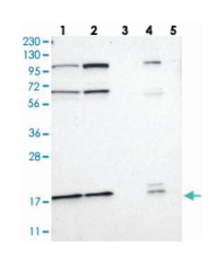 C11orf59, Rabbit, Polyclonal Antibody, Abnova 100 &mu;L | Buy Online | Abnova Corporation | Fisher Scientific