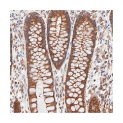 CD2AP Rabbit anti-Human, Mouse, Rat, Polyclonal Antibody, Abnova 100 &mu;L | Buy Online | Abnova Corporation | Fisher Scientific