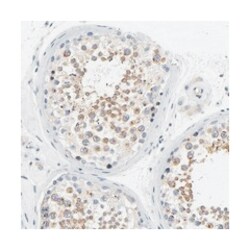 LMAN2, Rabbit, Polyclonal Antibody, Abnova 100&mu;L; Unlabeled:Antibodies,