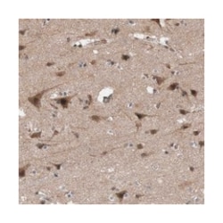 KANSL1 Rabbit anti-Human, Polyclonal Antibody, Abnova 100 &mu;L | Buy Online | Abnova Corporation | Fisher Scientific