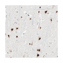 RCOR3, Rabbit, Polyclonal Antibody, Abnova 100&mu;L; Unlabeled:Antibodies,