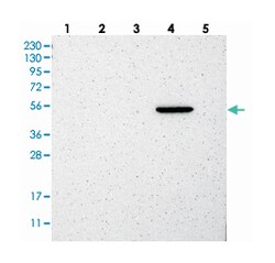 MANSC1 Rabbit anti-Human, Polyclonal Antibody, Abnova 100&mu;L; Unlabeled:Antibodies,