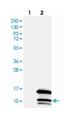 CCDC23, Rabbit, Polyclonal Antibody, Abnova 100&mu;L; Unlabeled:Antibodies,
