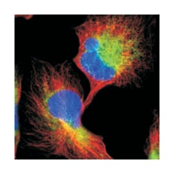 CLCC1 Rabbit anti-Human, Polyclonal Antibody, Abnova 100 &mu;L | Buy Online | Abnova Corporation | Fisher Scientific