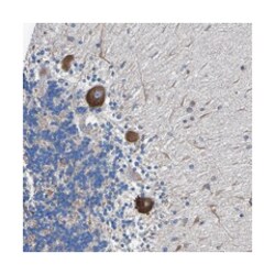 CCDC90B Rabbit anti-Human, Polyclonal Antibody, Abnova 100 &mu;L | Buy Online | Abnova Corporation | Fisher Scientific