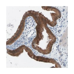 SCNN1A, Rabbit, Polyclonal Antibody, Abnova 100&mu;L; Unlabeled:Antibodies,