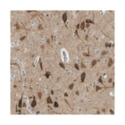 KCTD10, Rabbit, Polyclonal Antibody, Abnova 100&mu;L; Unlabeled:Antibodies,