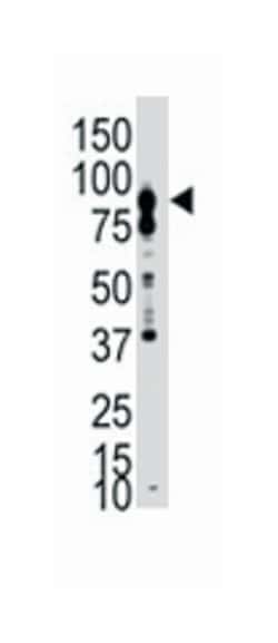 EPHB6 Rabbit anti-Human, Polyclonal Antibody, Abnova 400&mu;L; Unlabeled:Antibodies,
