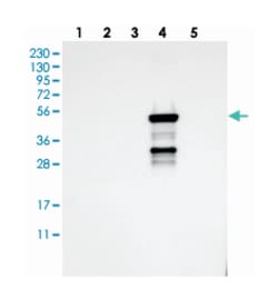 CYP2C19 Rabbit anti-Human, Polyclonal Antibody, Abnova 100 &mu;L | Buy Online | Abnova | Fisher Scientific
