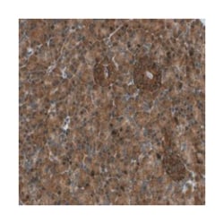 TBC1D15 Rabbit anti-Human, Polyclonal Antibody, Abnova 100 &mu;L | Buy Online | Abnova Corporation | Fisher Scientific