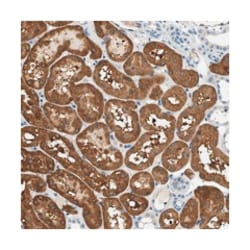 SLC35E1, Rabbit, Polyclonal Antibody, Abnova 100&mu;L; Unlabeled:Antibodies,