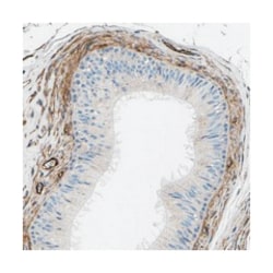 COL15A1 Rabbit anti-Human, Polyclonal Antibody, Abnova 100 &mu;L | Buy Online | Abnova Corporation | Fisher Scientific