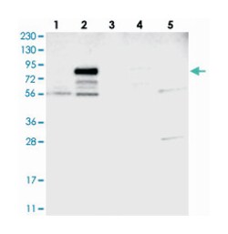 ATP6V0A4 Rabbit anti-Human, Polyclonal Antibody, Abnova 100&mu;L; Unlabeled:Antibodies,