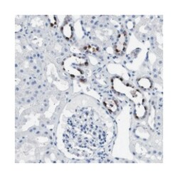 ATP6V0A4 Rabbit anti-Human, Polyclonal Antibody, Abnova 100&mu;L; Unlabeled:Antibodies,