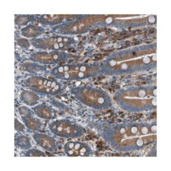 EDARADD, Rabbit, Polyclonal Antibody, Abnova 100&mu;L; Unlabeled:Antibodies,