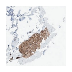 FAM18B, Rabbit, Polyclonal Antibody, Abnova 100 &mu;L | Buy Online | Abnova Corporation | Fisher Scientific